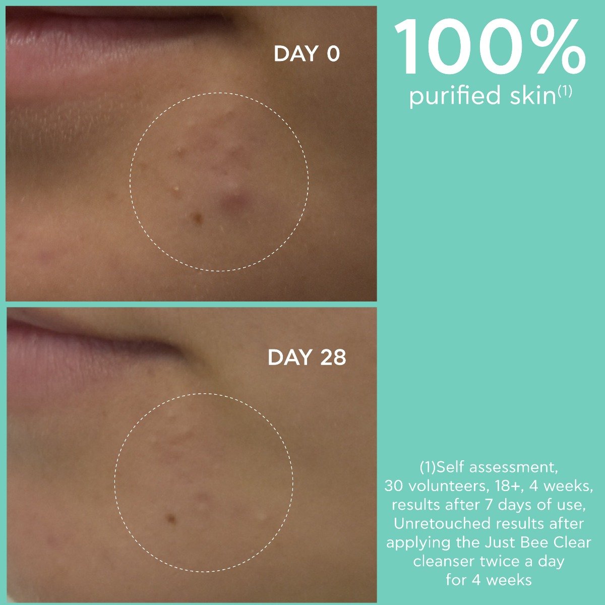 Purifying Cleanser Gel 10-22-01-742 | APIVITA