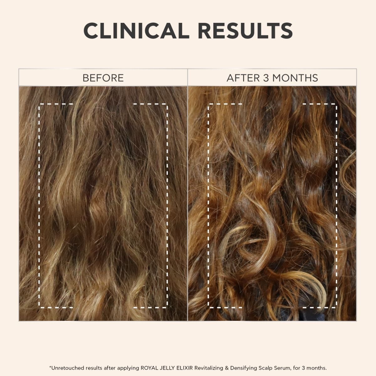 Revitalizing & Densifying Scalp Serum 65238341 | APIVITA