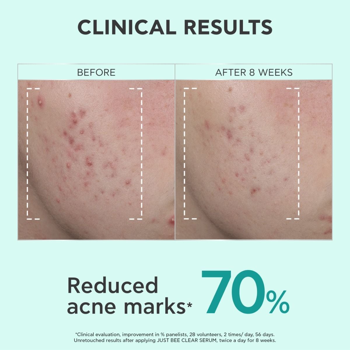 Anti-blemishes, Anti-marks, Refining Serum 65241436 | APIVITA